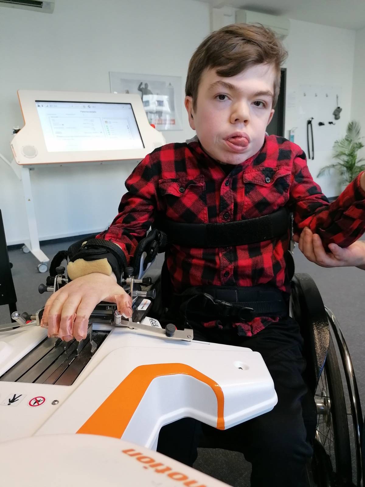 das Kind mit Hunter-Syndrom