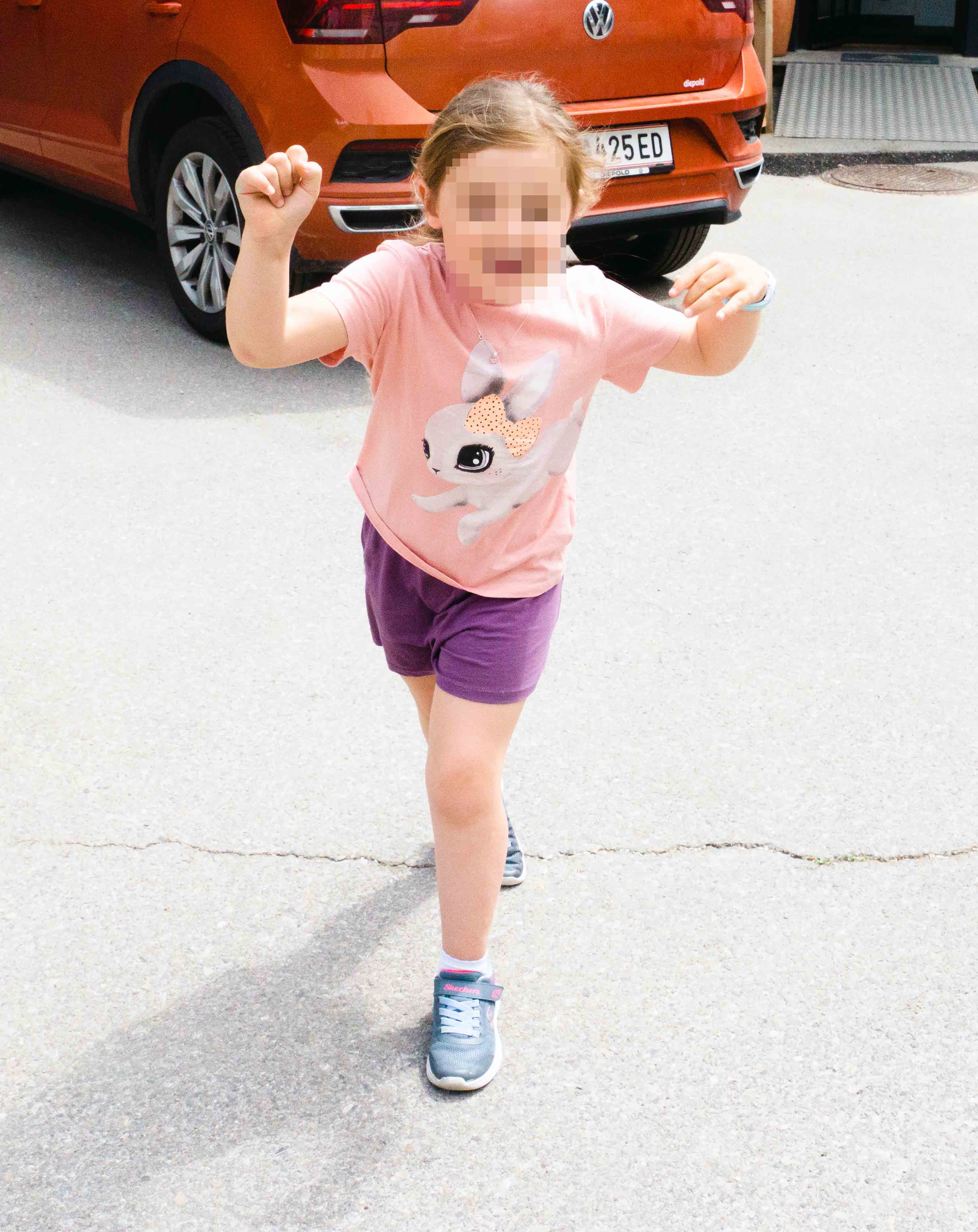 Durch eine Myofasziotomie kommt Lara mit den Fersen auf den Boden. Nun fehlt ihr die Kraft die Muskulatur gezielt anzusteuern.
