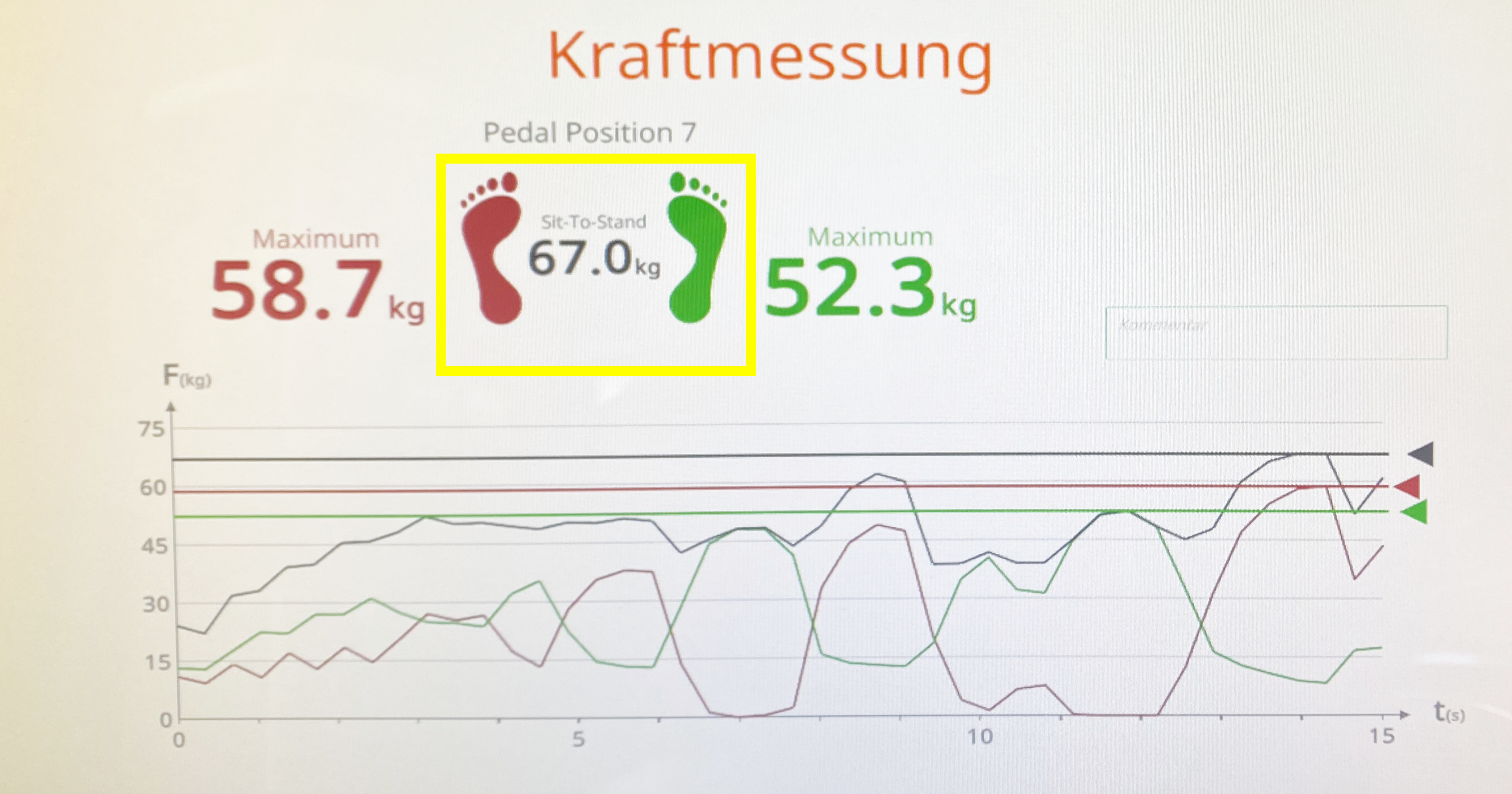 Kraftmessung Bild