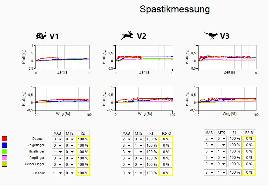Spastikmessung Bild 2