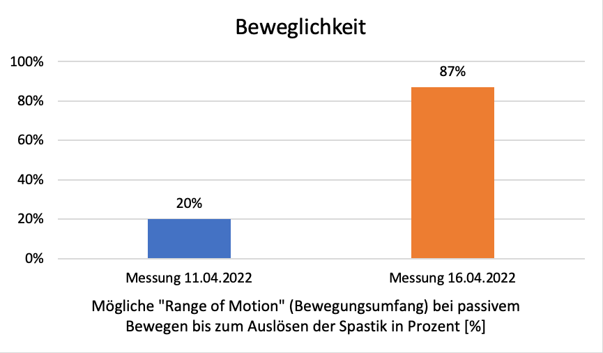Beweglichkeit Bild