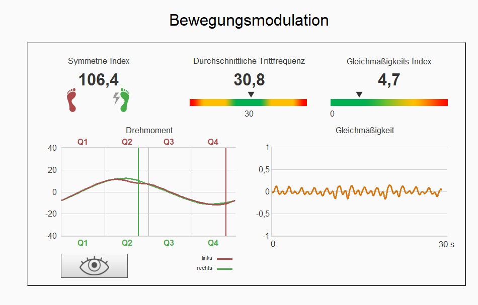 Bewegungsmodulation - Bild